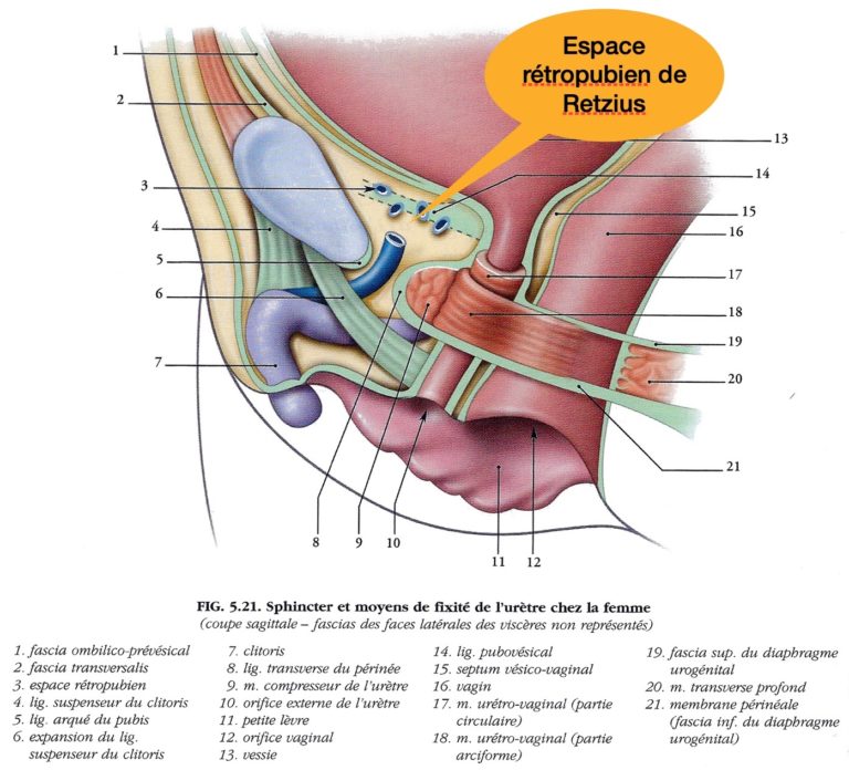 Endométriose, aspect gynécologique, urinaire et anal – Ostéopathe ...